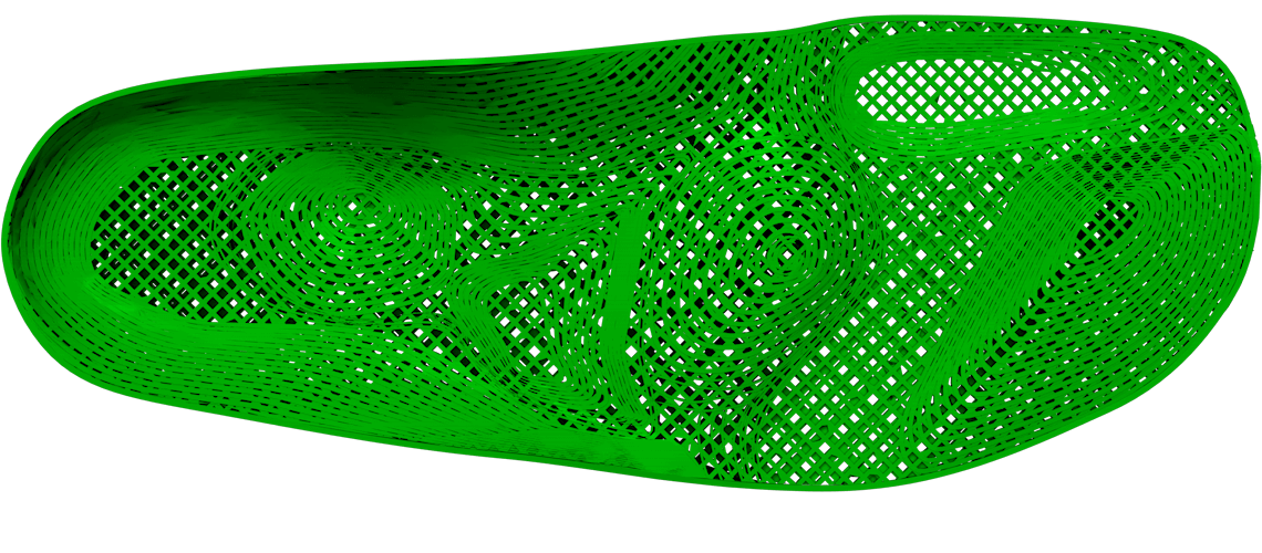 3D-gedruckte Maßeinlage